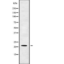 Invitrogen OAZ2 Polyclonal Antibody 100 &mu;L | Buy Online | Invitrogen&trade; | Fisher Scientific