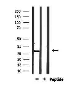 Invitrogen OAZ3 Polyclonal Antibody 100 &mu;L; Unconjugated:Antibodies,