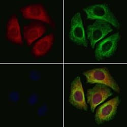 P2X1 Polyclonal Antibody:Antibodies, Polyclonal