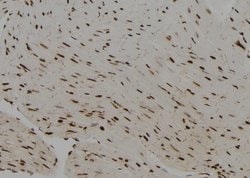 Invitrogen PRRX2 Polyclonal Antibody 100 &mu;L; Unconjugated:Antibodies,