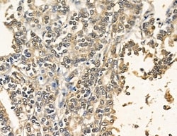 Invitrogen PRRX2 Polyclonal Antibody 100 &mu;L; Unconjugated:Antibodies,