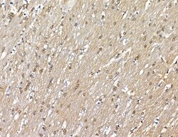 Invitrogen PRRX2 Polyclonal Antibody 100 &mu;L; Unconjugated:Antibodies,