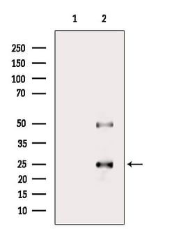 Invitrogen PRRX2 Polyclonal Antibody 100 &mu;L; Unconjugated:Antibodies,