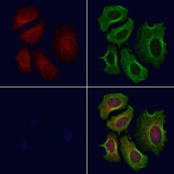 Invitrogen CROT Polyclonal Antibody 100 &mu;L; Unconjugated:Antibodies,