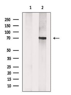Invitrogen CROT Polyclonal Antibody 100 &mu;L; Unconjugated:Antibodies,