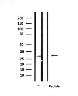 Invitrogen PEX11A Polyclonal Antibody 100 &mu;L | Buy Online | Invitrogen&trade; | Fisher Scientific