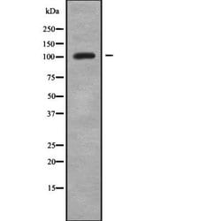 Invitrogen PEX6 Polyclonal Antibody 100 &mu;L | Buy Online | Invitrogen&trade; | Fisher Scientific