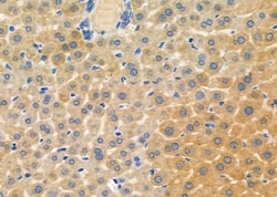 Invitrogen PEX12 Polyclonal Antibody 100 &mu;L; Unconjugated:Antibodies,
