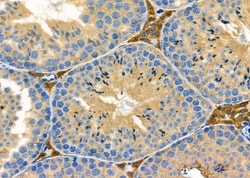 Invitrogen PEX12 Polyclonal Antibody 100 &mu;L; Unconjugated:Antibodies,
