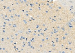 Invitrogen PEX12 Polyclonal Antibody 100 &mu;L; Unconjugated:Antibodies,
