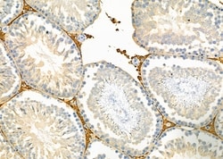 Invitrogen PEX12 Polyclonal Antibody 100 &mu;L; Unconjugated:Antibodies,
