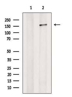 Invitrogen PREX1 Polyclonal Antibody 100 &mu;L | Buy Online | Invitrogen&trade; | Fisher Scientific