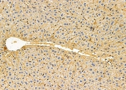 Invitrogen INPP5J Polyclonal Antibody 100 &mu;L; Unconjugated:Antibodies,