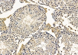 Invitrogen INPP5J Polyclonal Antibody 100 &mu;L; Unconjugated:Antibodies,