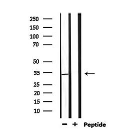 Invitrogen PIGC Polyclonal Antibody 100 &mu;L; Unconjugated:Antibodies,