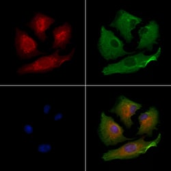 PIGP Polyclonal Antibody:Antibodies, Polyclonal