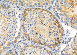 PIGP Polyclonal Antibody:Antibodies, Polyclonal