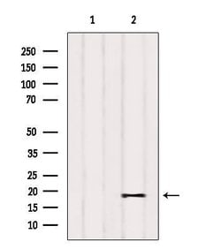 PIGP Polyclonal Antibody:Antibodies, Polyclonal