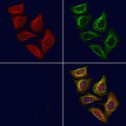 Invitrogen PIGQ Polyclonal Antibody 100 &mu;L; Unconjugated:Antibodies,