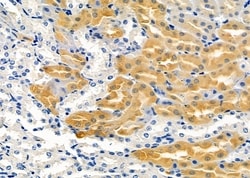 Invitrogen PIGQ Polyclonal Antibody 100 &mu;L; Unconjugated:Antibodies,