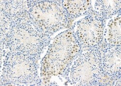 Invitrogen PIGQ Polyclonal Antibody 100 &mu;L; Unconjugated:Antibodies,