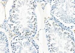 Invitrogen PIGQ Polyclonal Antibody 100 &mu;L; Unconjugated:Antibodies,