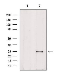 Invitrogen PIGF Polyclonal Antibody 100 &mu;L | Buy Online | Invitrogen&trade; | Fisher Scientific
