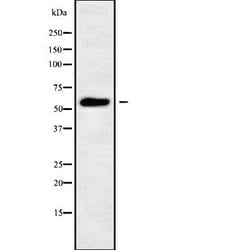 Invitrogen PIGW Polyclonal Antibody 100 &mu;L; Unconjugated:Antibodies,