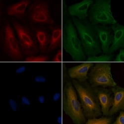 Invitrogen PIK3R6 Polyclonal Antibody 100 &mu;L; Unconjugated:Antibodies,