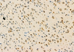 Invitrogen PIK3R6 Polyclonal Antibody 100 &mu;L; Unconjugated:Antibodies,