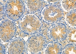 Invitrogen PIK3R6 Polyclonal Antibody 100 &mu;L; Unconjugated:Antibodies,