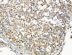 Invitrogen ATP2B1/2/3 Polyclonal Antibody 100 &mu;L | Buy Online | Invitrogen&trade; | Fisher Scientific