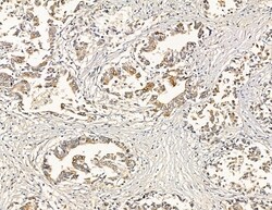 Invitrogen ATP2B1/2/3 Polyclonal Antibody 100 &mu;L | Buy Online | Invitrogen&trade; | Fisher Scientific