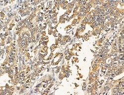 Invitrogen ATP2B1/2/3 Polyclonal Antibody 100 &mu;L | Buy Online | Invitrogen&trade; | Fisher Scientific