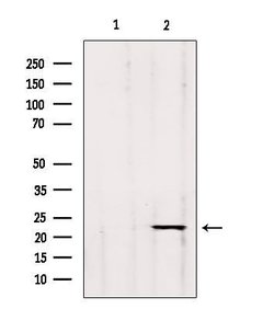 GP1BB Polyclonal Antibody:Antibodies, Polyclonal