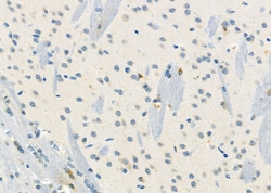 Invitrogen KCNE3 Polyclonal Antibody 100 &mu;L; Unconjugated:Antibodies,