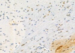 Invitrogen KCNE3 Polyclonal Antibody 100 &mu;L; Unconjugated:Antibodies,