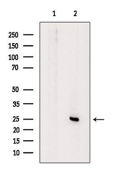 Invitrogen KCNE3 Polyclonal Antibody 100 &mu;L; Unconjugated:Antibodies,