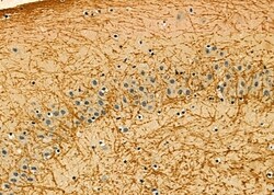 Invitrogen APOBEC3A/APOBEC3B Polyclonal Antibody 100 &mu;L | Buy Online | Invitrogen&trade; | Fisher Scientific