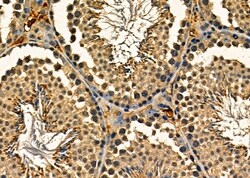 Invitrogen APOBEC3A/APOBEC3B Polyclonal Antibody 100 &mu;L | Buy Online | Invitrogen&trade; | Fisher Scientific