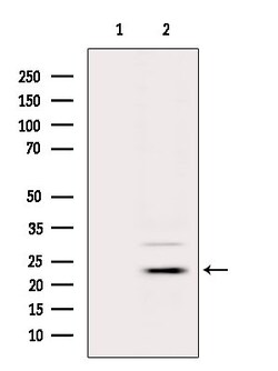Invitrogen APOBEC3A/APOBEC3B Polyclonal Antibody 100 &mu;L | Buy Online | Invitrogen&trade; | Fisher Scientific
