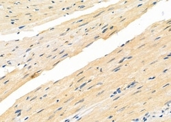 Invitrogen PP14B Polyclonal Antibody 100 &mu;L; Unconjugated:Antibodies,