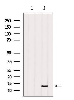 Invitrogen PPP1R1C Polyclonal Antibody 100 &mu;L | Buy Online | Invitrogen&trade; | Fisher Scientific