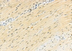 Invitrogen PPP1R3D Polyclonal Antibody 100 &mu;L | Buy Online | Invitrogen&trade; | Fisher Scientific