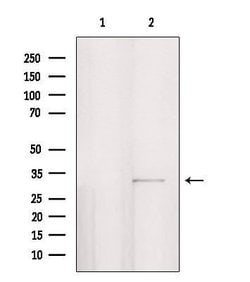 Invitrogen PPP1R3D Polyclonal Antibody 100 &mu;L | Buy Online | Invitrogen&trade; | Fisher Scientific