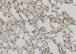 Invitrogen PPP1R2P3 Polyclonal Antibody 100 &mu;L; Unconjugated:Antibodies,