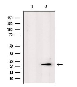 Invitrogen PPP1R2P3 Polyclonal Antibody 100 &mu;L; Unconjugated:Antibodies,