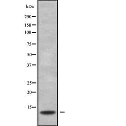 Invitrogen S100G Polyclonal Antibody 100 &mu;L; Unconjugated:Antibodies,