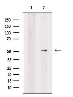 Invitrogen SERPINA10 Polyclonal Antibody 100 &mu;L; Unconjugated:Antibodies,