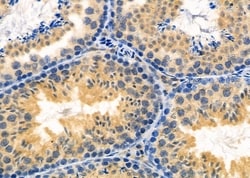 Invitrogen PAGE3 Polyclonal Antibody 100 &mu;L; Unconjugated:Antibodies,